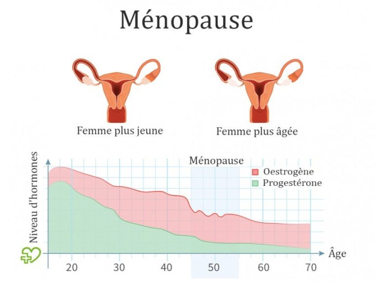 Ménopause : Comment La Vivre Sereinement – Ana-santé